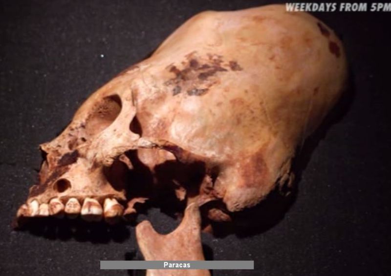 Paracas-elongated-skull-01-800x564.jpg